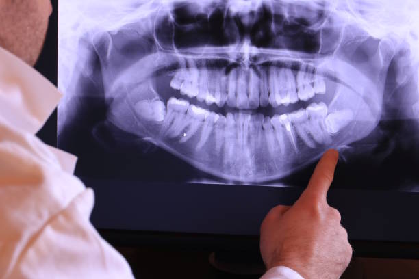 Best Emergency Broken Tooth Repair in Verdi, NV